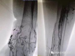 昆明吸脂比较好的医院(昆明哪家吸脂好)