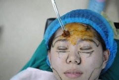 大概全身抽脂多少钱啊(全身抽脂的多少钱)