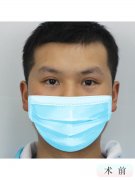 西安哪里割双眼皮比较好(西安哪里割双眼皮性价比高)