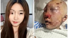 被打女孩穿着暴露了(被打女孩穿着暴露了)