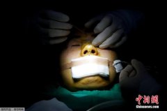 整形医生在线咨询免费(整形外科在线咨询免费)