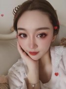 泪沟填充一周左右图片(填充泪沟三天图片)