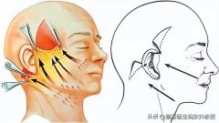 手术要多少钱(术大概多少钱)