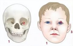 一边脸肌肉大怎么瘦脸(脸部有肌肉怎么瘦脸)