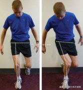 腿部肌肉外翻怎么办(大腿肌肉外翻怎么办)