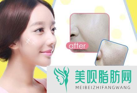 皮肤美容有用吗?冬天喝什么美容养颜皮肤好?