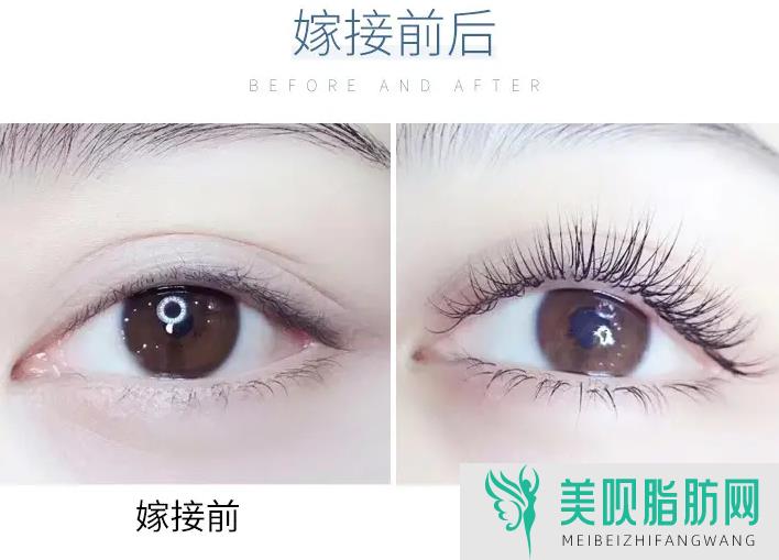 【快讯】重庆排名前三的割双眼皮医院情况如下,top5全新盘点