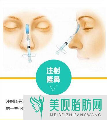 高手详解石家庄假体隆鼻术后注意哪些方面,石家庄整容隆鼻手术
