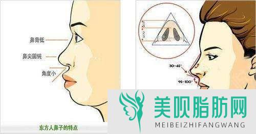 广州修复鼻子的好时机是在什么时候呢,广州修复鼻子厉害的医生
