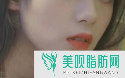 软骨隆鼻术后注意事项,软骨隆鼻术后注意事项有哪些