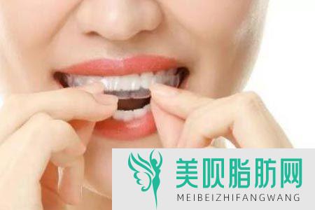 桃子姐聊聊南京牙齿美白价位,南京牙齿美白多少钱