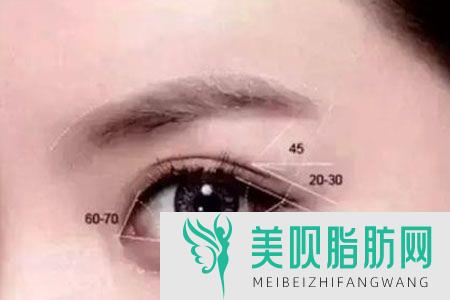 无锡开眼角整形医院排行榜前五(无锡整形医院排名前十)