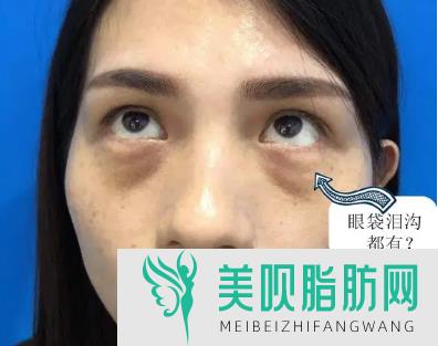 武汉双眼皮医院排名榜(武汉双眼皮医院排名榜新)