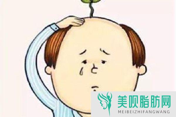 植发为什么这么贵(植发为什么这么贵而且容易掉)