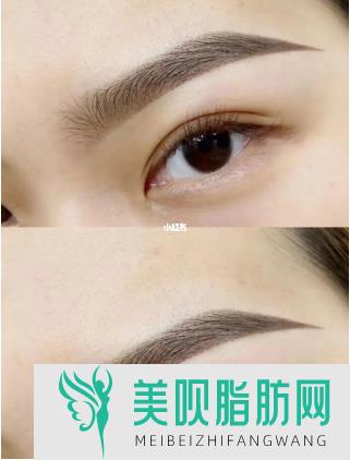 重庆眼部整形哪个医院好呢(重庆眼部整形哪个医院好呢)