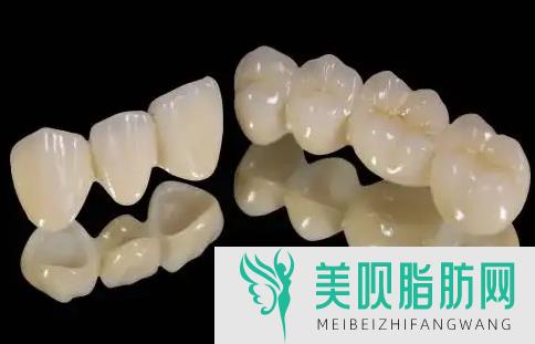 「今日爆」宜昌牙齿矫正价格多少钱一颗,宜昌牙齿矫正价格多少钱