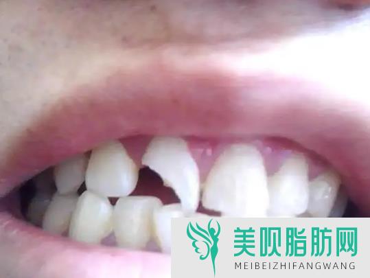 「热点」苏州牙科医院排名榜,苏州牙科医院排名前十的都有谁