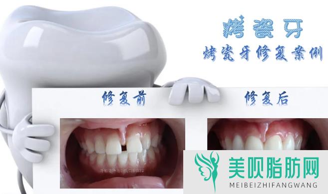 「通报」南通牙科医院排名前十榜公布(合肥牙科医院排名前十)