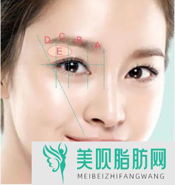 做个眼袋抽脂多少钱,做个眼睛抽脂多少钱啊