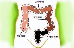 便秘怎么排宿便(便秘排宿便有的方法)