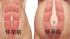 产后怎么瘦小腹(产后怎么瘦小腹快)