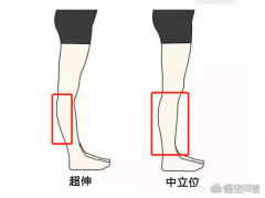 小腿肚子大怎么减肥(小腿肚子大怎么减肥快)
