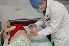 火疗减肥瘦腿会反弹吗(火疗减肥十次瘦多少)