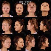 脸颊肉多怎么瘦(脸颊肉多怎么瘦下来学生)