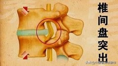 腰不直怎么锻炼方法(腰不直怎么锻炼方法有)