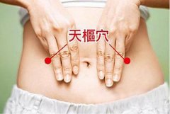 拔罐 瘦腿