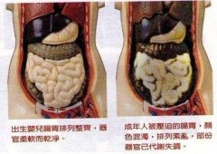 怎么能把肚子里的宿便排出去(怎么能把肚子里的宿便排出去呢)