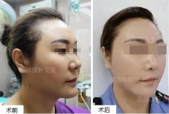 怎么快速胖脸(如何快速胖脸)