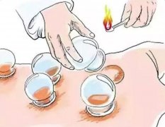 拔罐减肥期间体重怎么变化(拔罐减肥拔完罐体重增加)