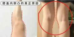 大腿内侧变胖了怎么减(大腿内侧很肥怎么减)