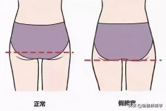 瘦大腿瘦腰瘦胯骨有什么方法(怎么做瘦腰和胯部位)