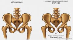 耻骨肌锻炼方法(耻部肌肉怎么练)