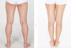 怎么看小腿肌肉(怎么看小腿肌肉是松弛还是紧绷)