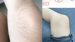 按摩瘦腿的快方法视频(腿部瘦腿按摩手法视频)