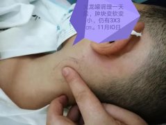 吃什么都长不胖怎么办(吃什么也长不胖怎么办)