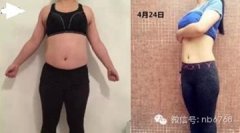 用石膏减肥怎么回事(石膏瘦腿会反弹吗)