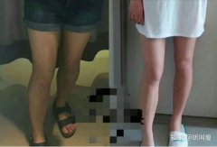 哪款瘦腿精油果好(什么精油可以瘦身瘦腿果好)