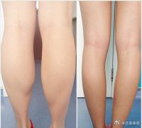 男生瘦大腿小腿的运动方法图解(如何瘦大腿屁股的男生运动方法)