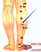 消除小腿水肿的方法(如何消小腿水肿)