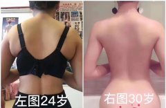 后背很厚怎么减(后背很厚怎么减下去)