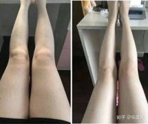 两个月瘦腿5厘米可能吗(2个月瘦腿)