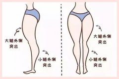 专门瘦腿的减肥药(药物瘦腿方法有哪些)