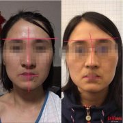 想要瘦脸应该怎么做(如果想瘦脸怎么做)