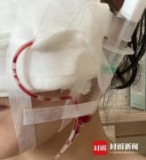 有什么瘦脸的中药方法是什么(瘦脸吃什么药)