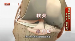 怎么做到可以翘二郎腿(怎样翘二郎腿)