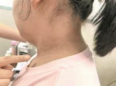 颈部怎么瘦(脖子怎么能瘦)